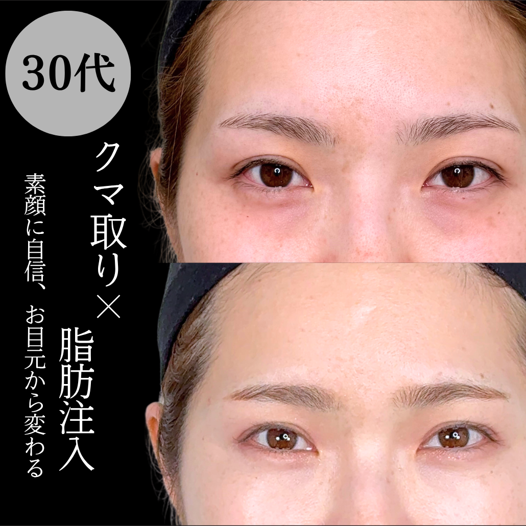 No.21373の症例写真