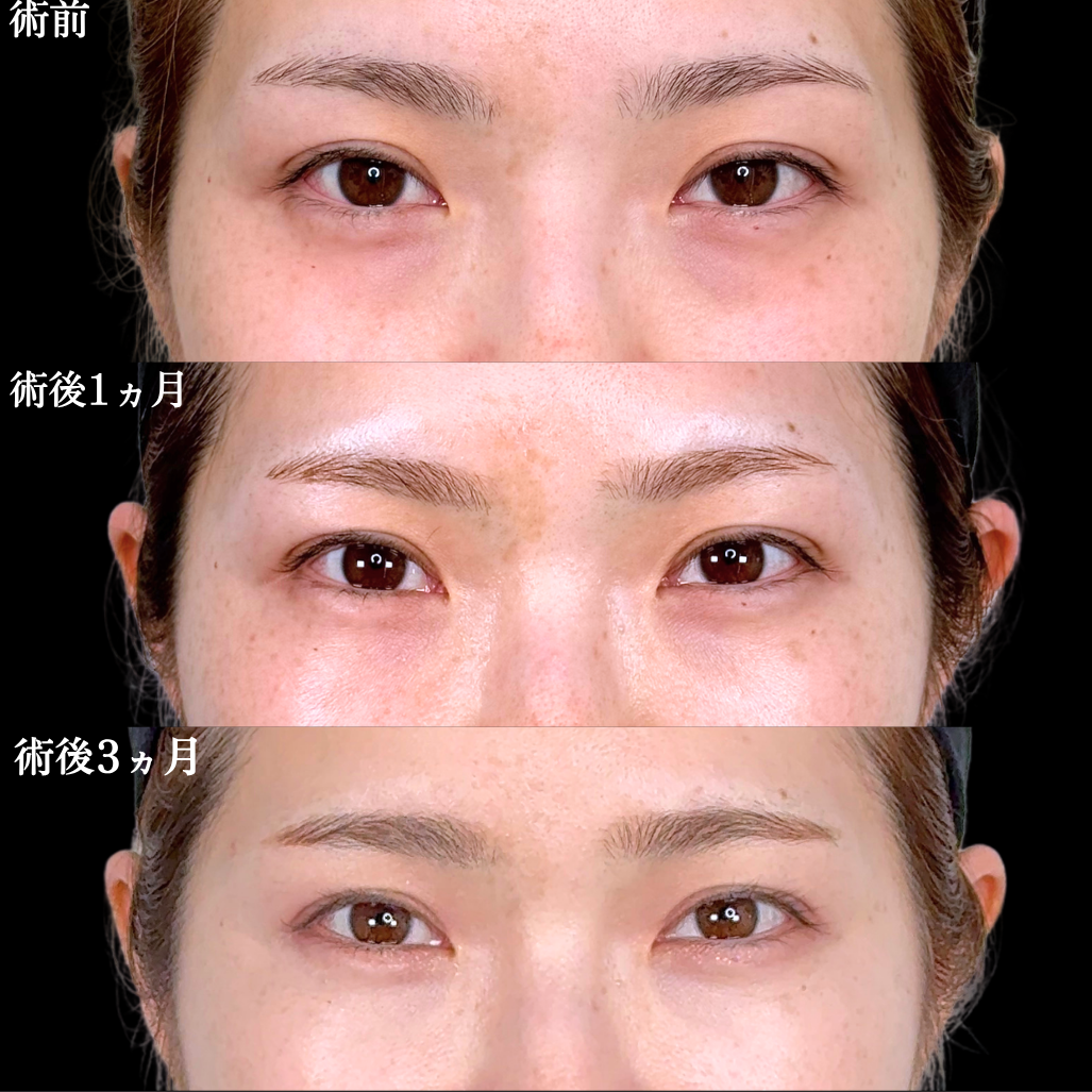No.21373の症例写真1