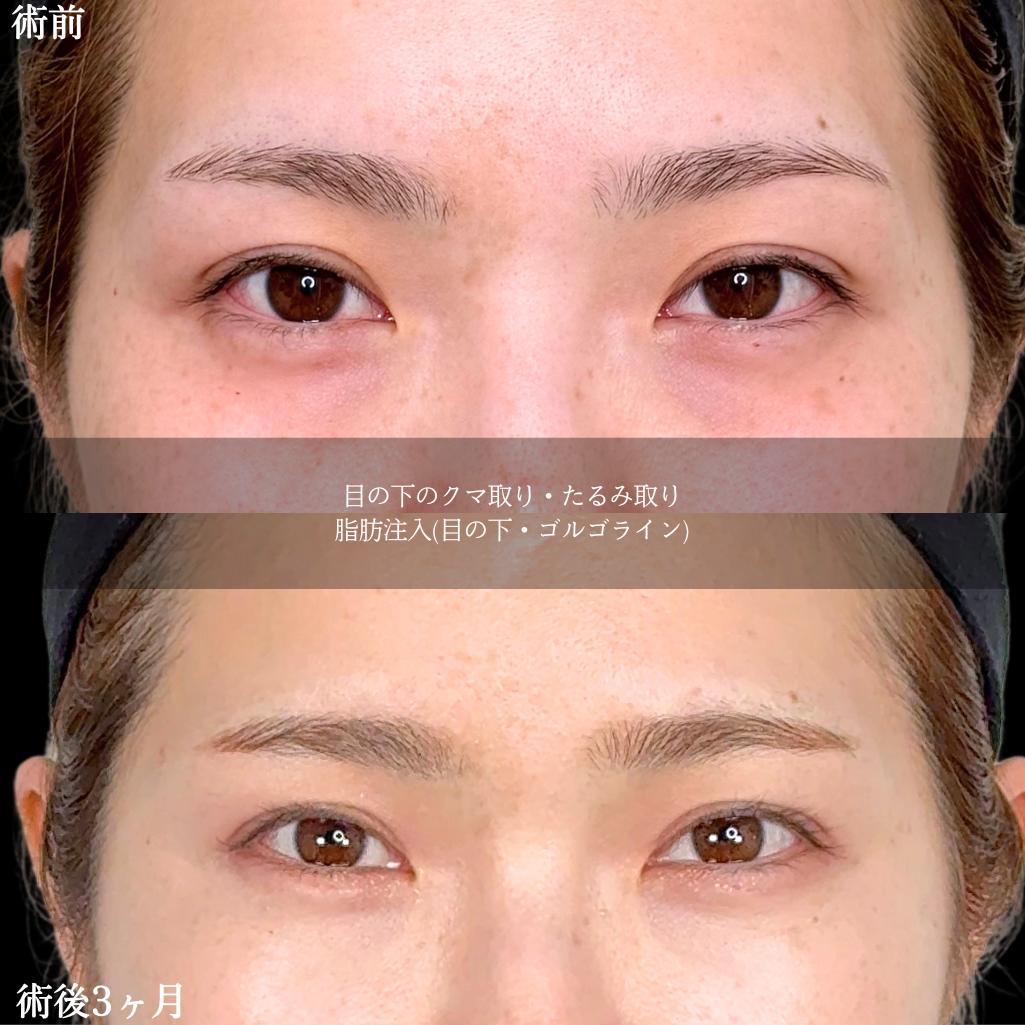 No.21373の症例写真2
