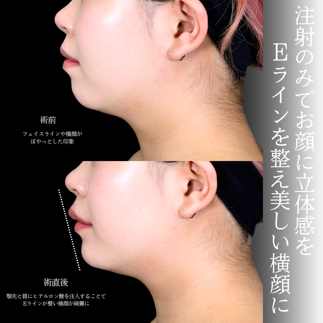 No.21421の症例写真1