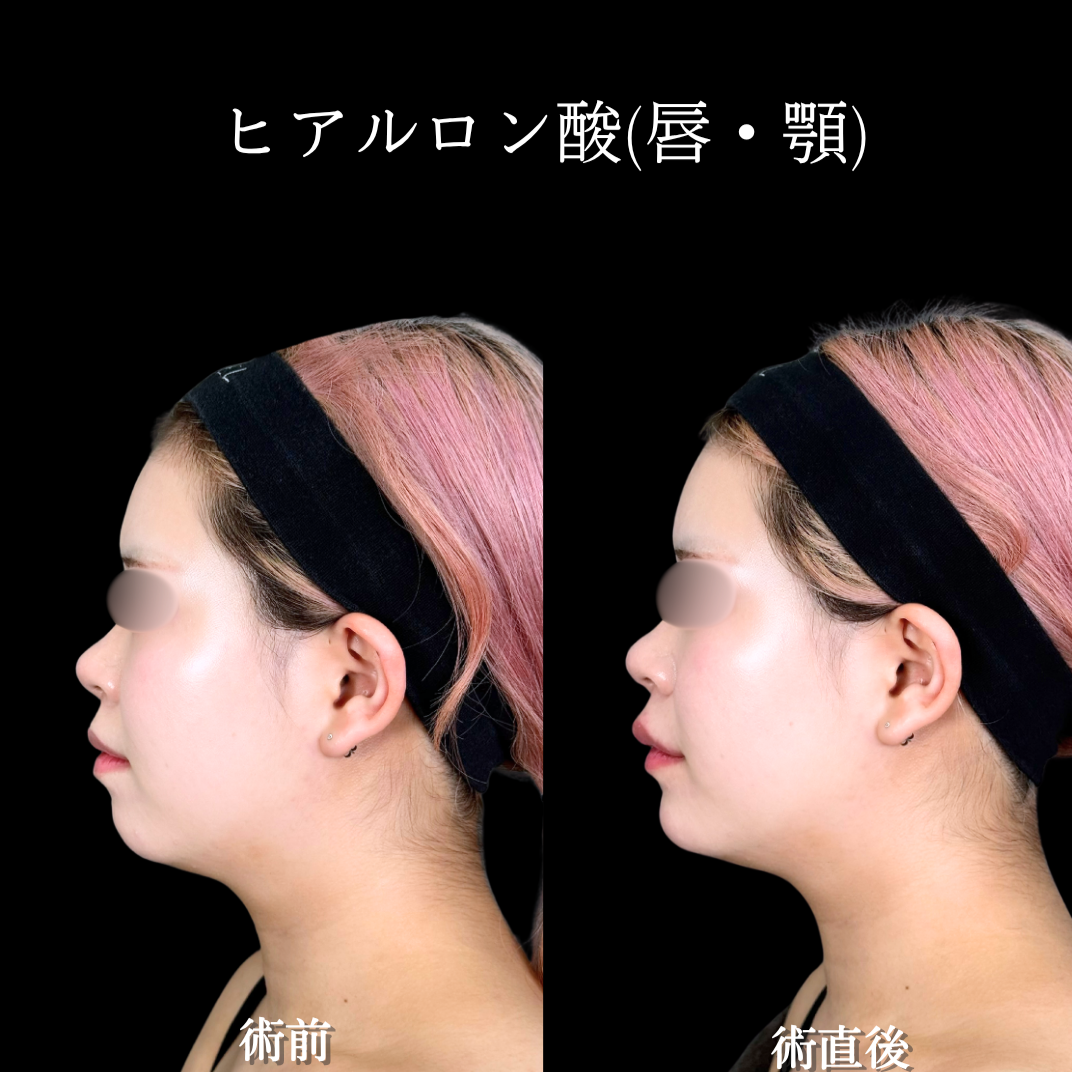 No.21421の症例写真2