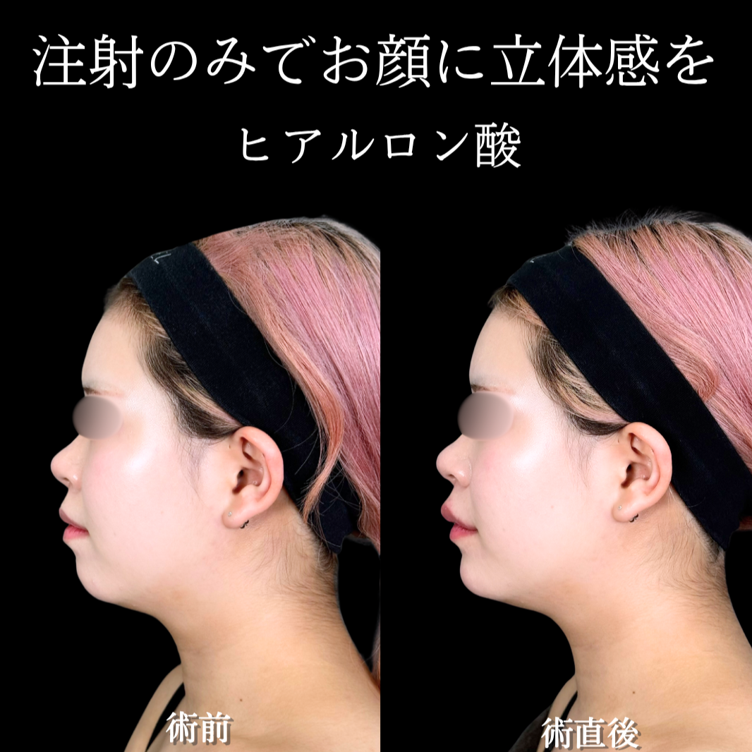 No.21421の症例写真