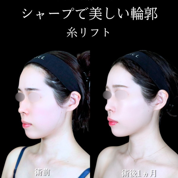 No.21970の症例写真