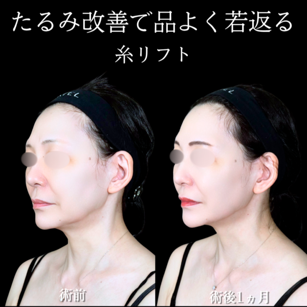 No.22221の症例写真
