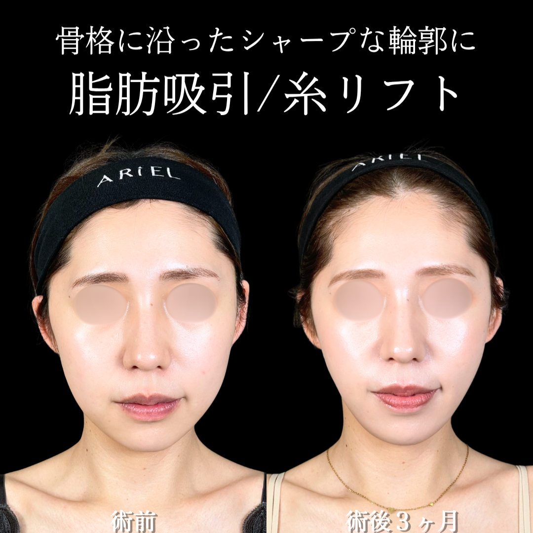 No.22262の症例写真