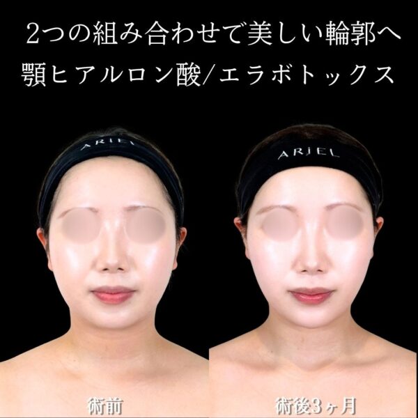 No.22155の症例写真 No.22155の症例写真