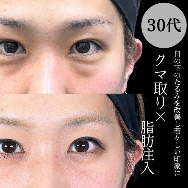 No.22052の症例写真