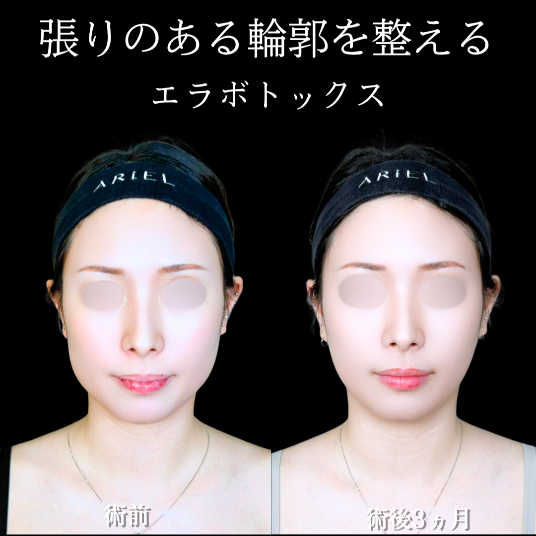 No.22120の症例写真