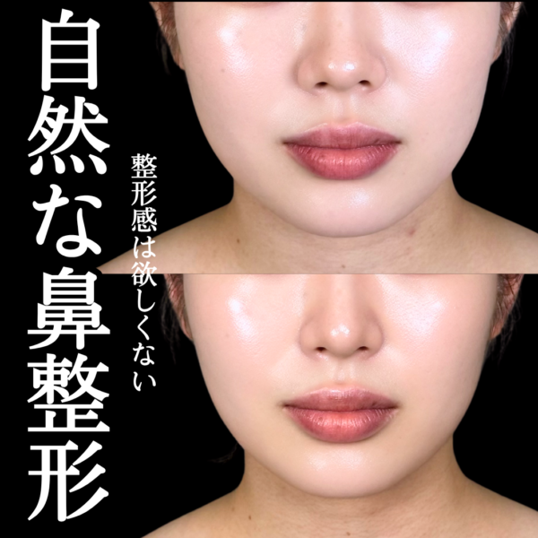 No.22188の症例写真