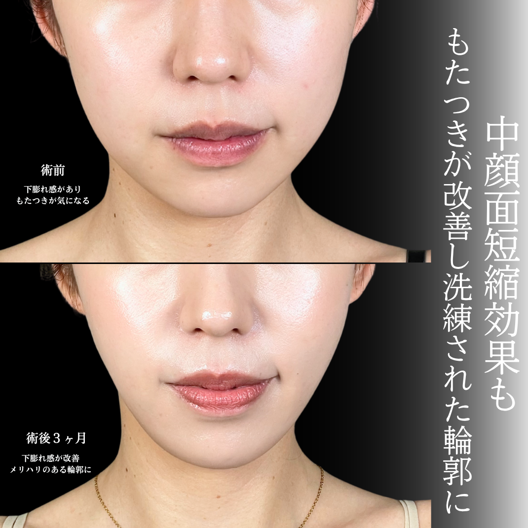 No.22262の症例写真1