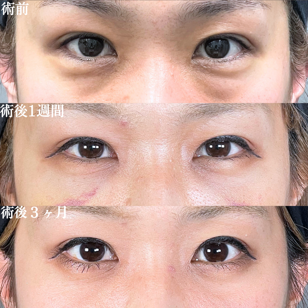 No.22052の症例写真1