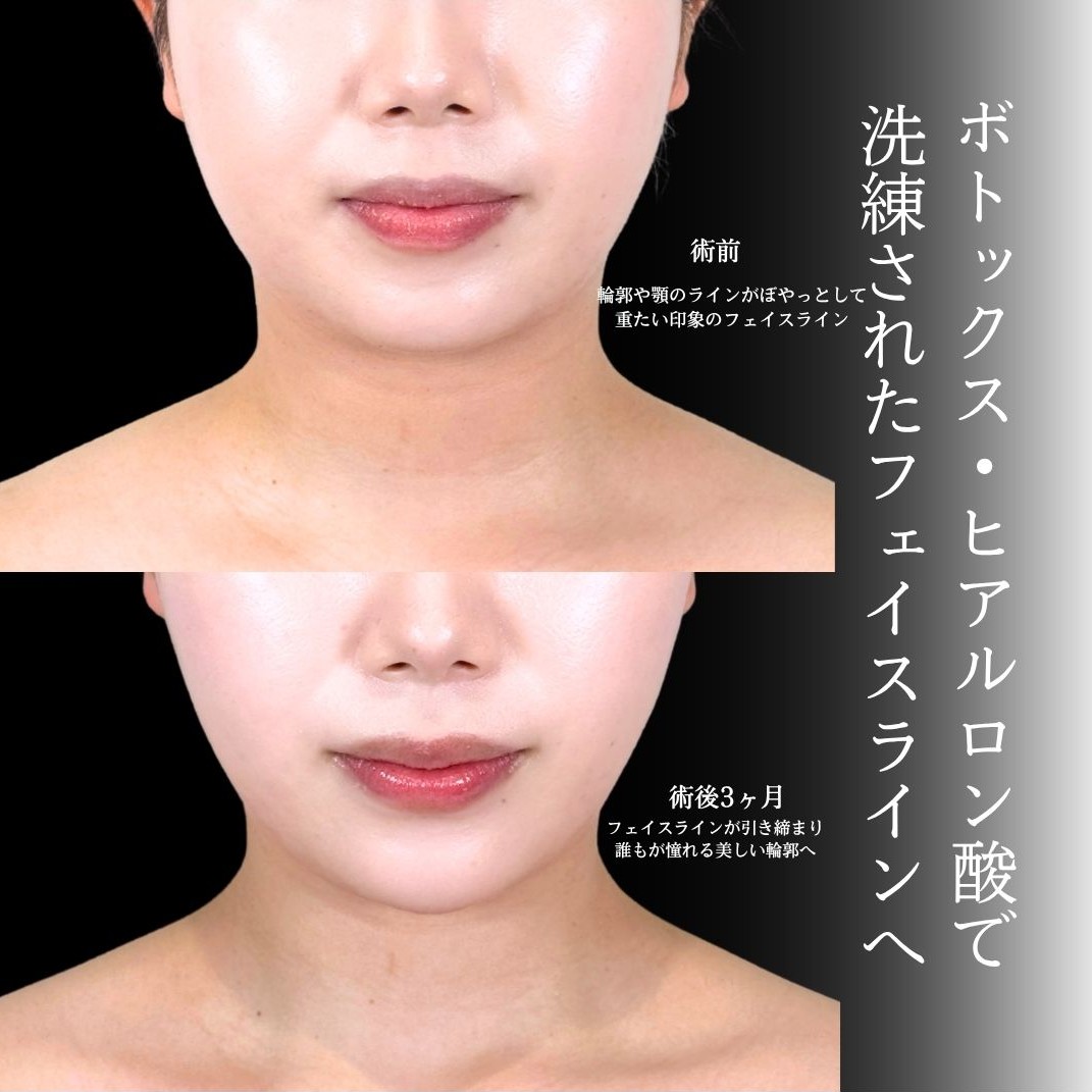 No.22155の症例写真1