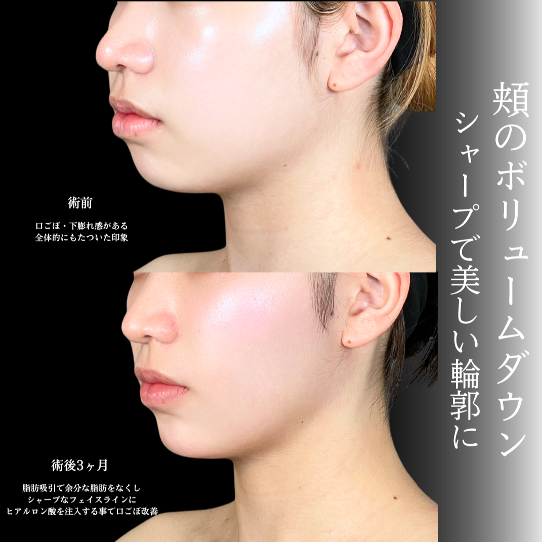 No.22092の症例写真1