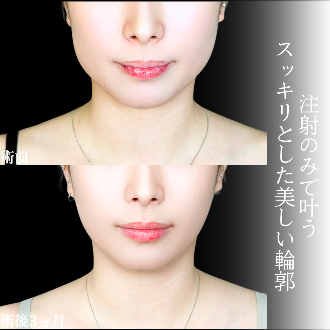 No.22120の症例写真1