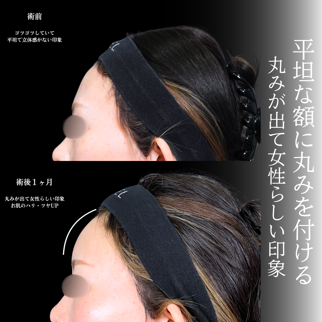 No.22207の症例写真1