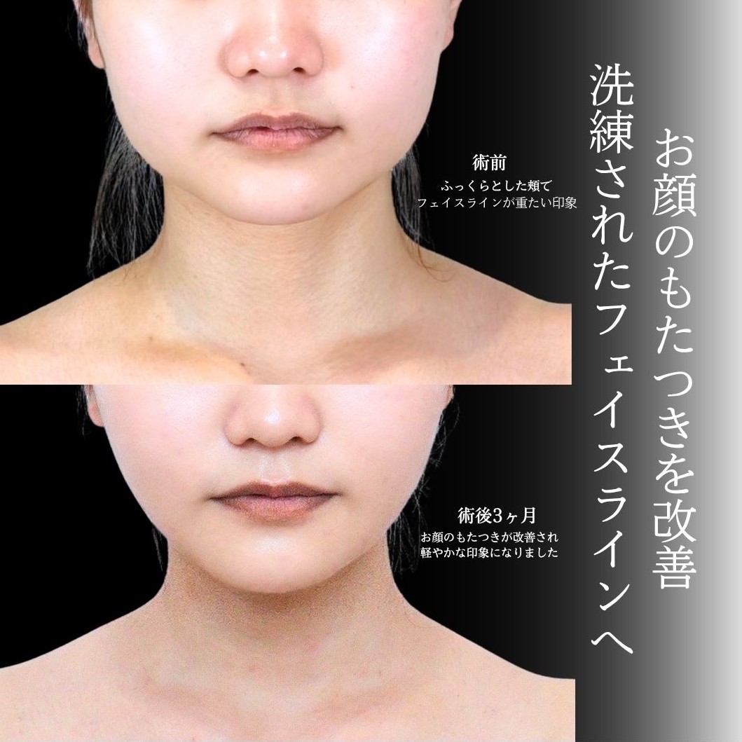 No.22009の症例写真1