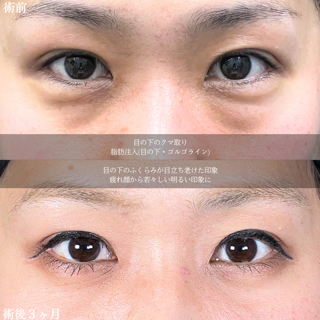 No.22052の症例写真2