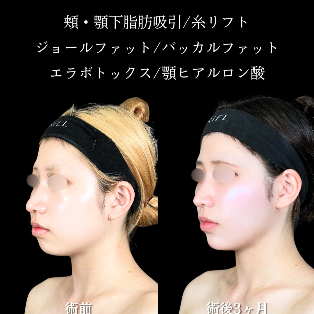 No.22092の症例写真2