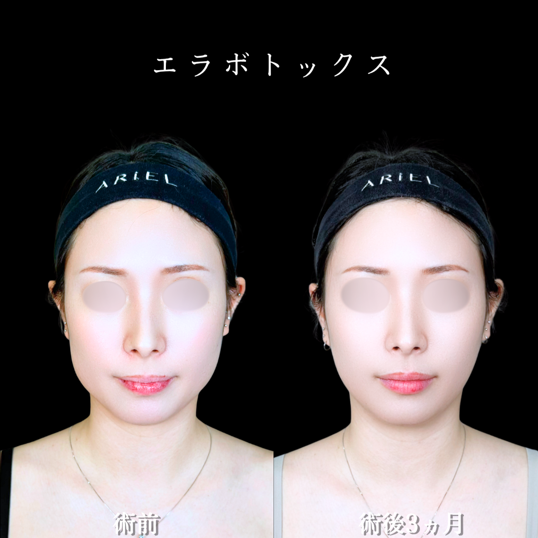 No.22120の症例写真2