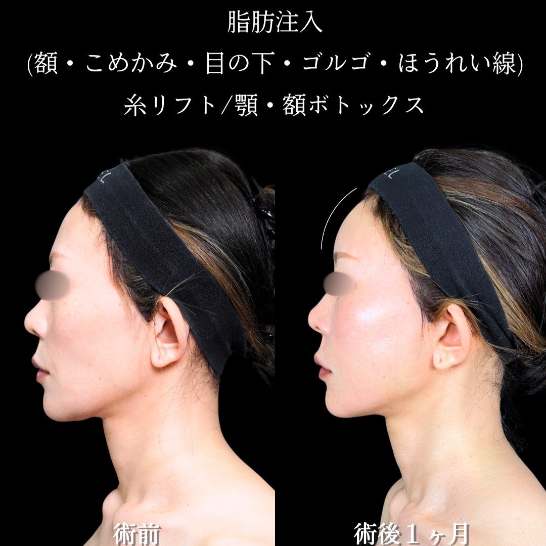 No.22207の症例写真2