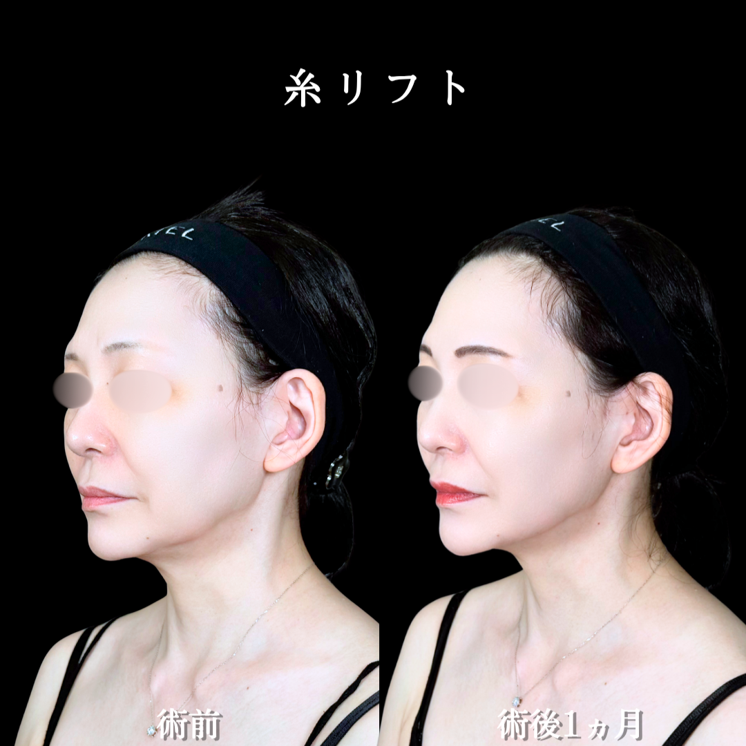 No.22221の症例写真2