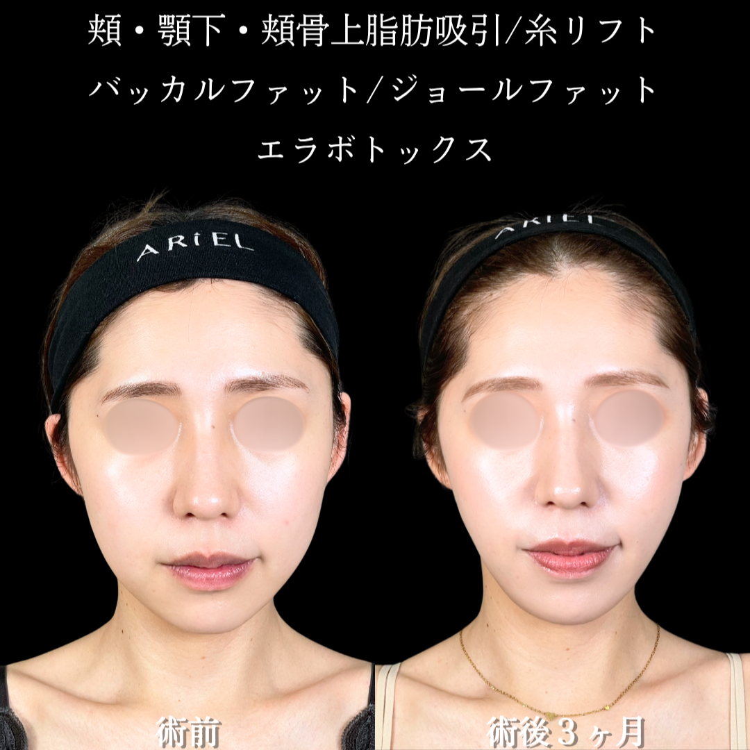 No.22262の症例写真2