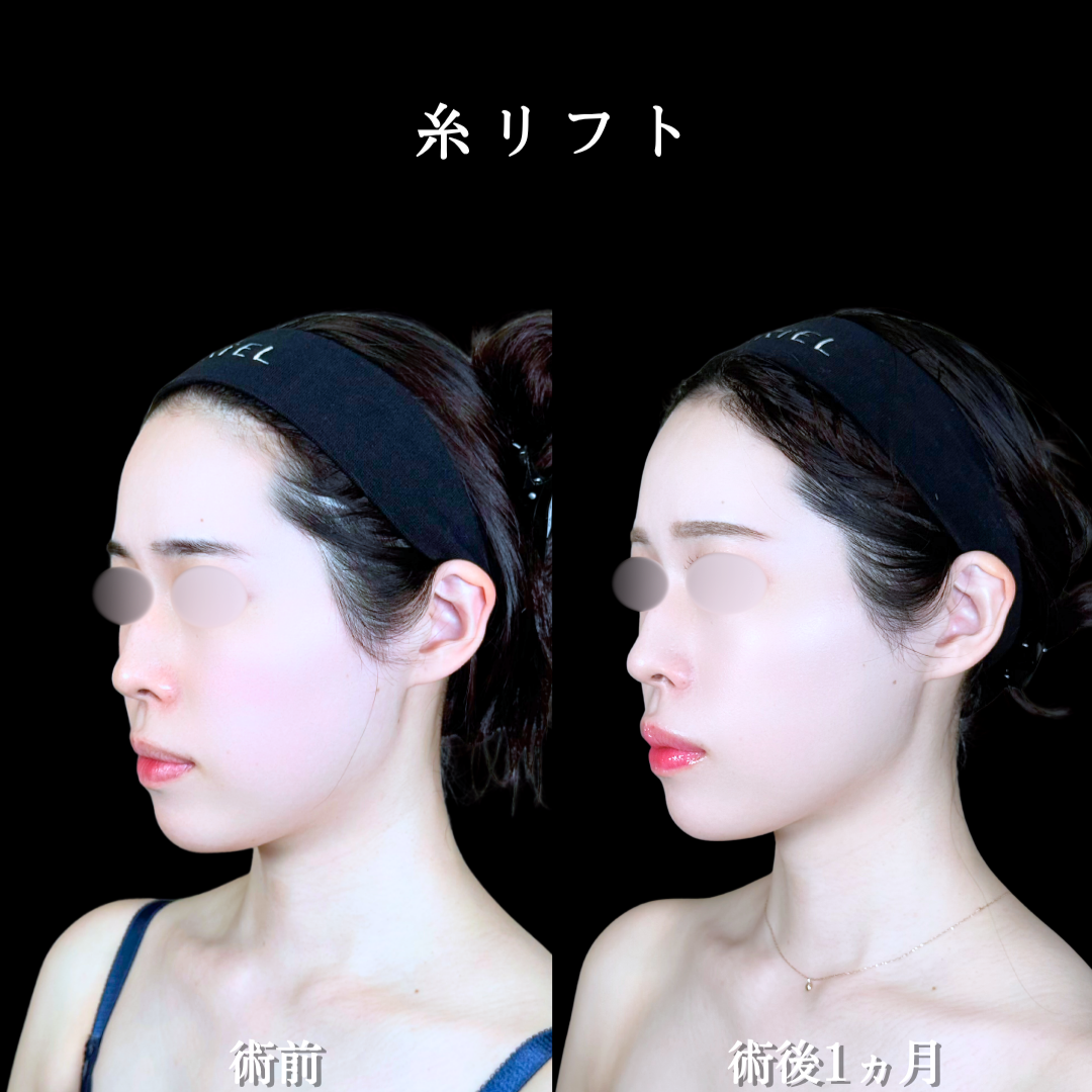 No.21970の症例写真2