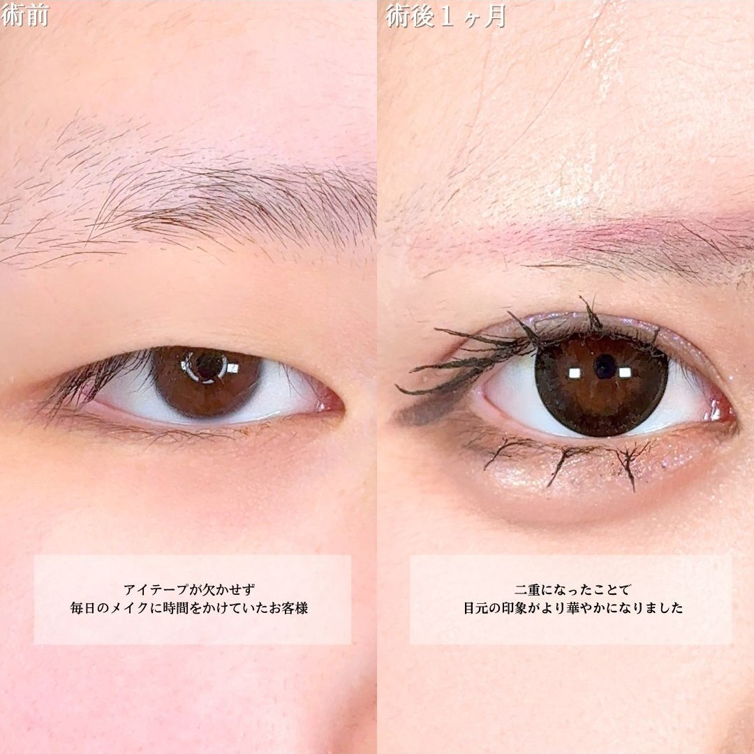No.22252の症例写真1