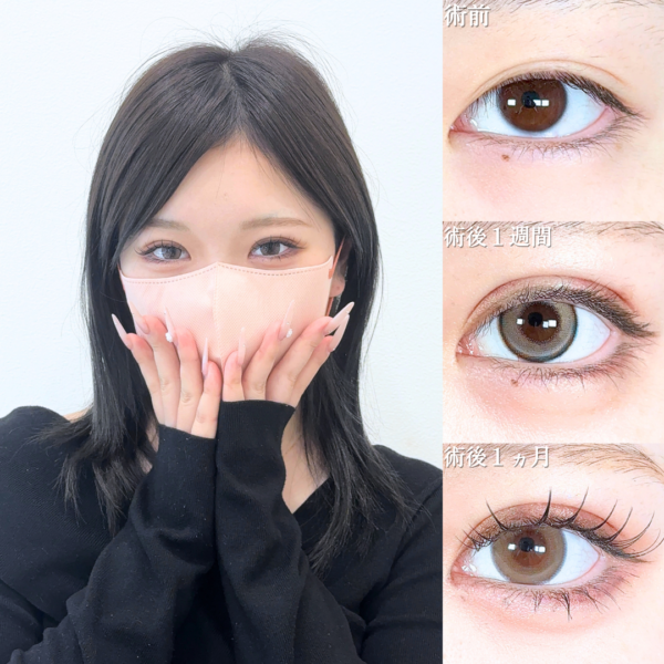 No.22276の症例写真