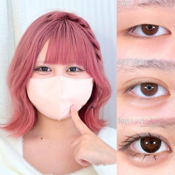 No.22252の症例写真