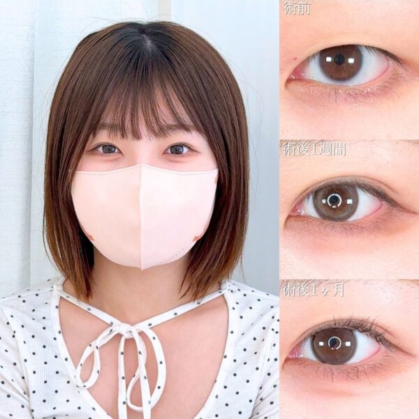No.22291の症例写真