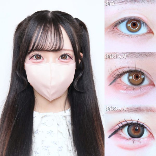 No.22269の症例写真