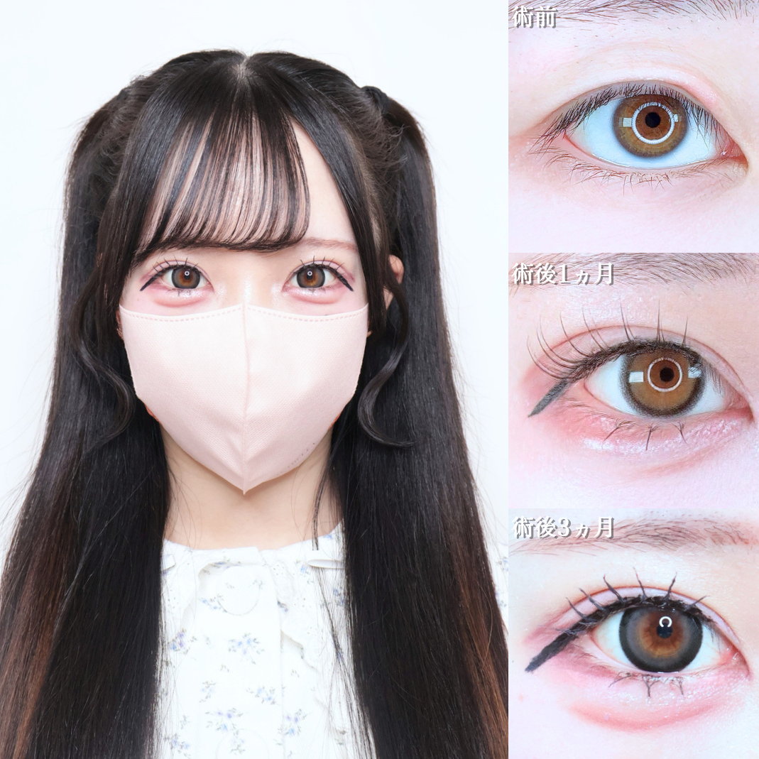 No.22269の症例写真