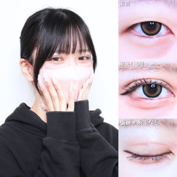 No.26145の症例写真
