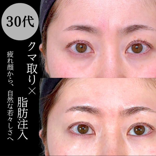 No.22006の症例写真