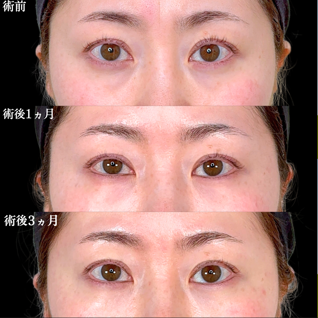 No.22006の症例写真1