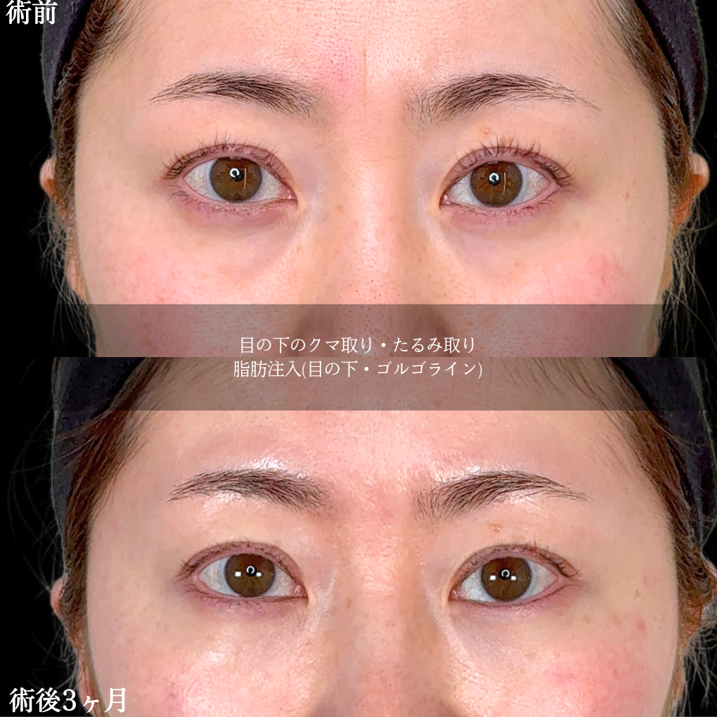 No.22006の症例写真2