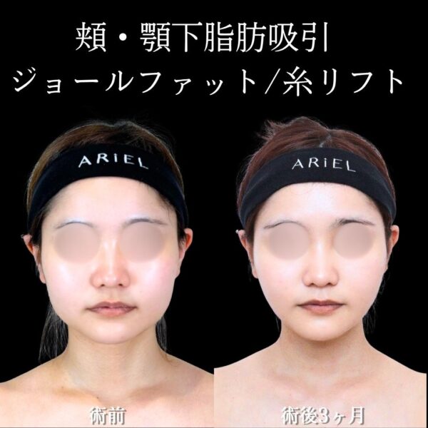 No.22009の症例写真