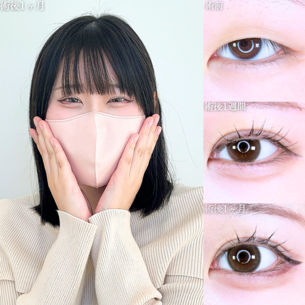 No.26140の症例写真