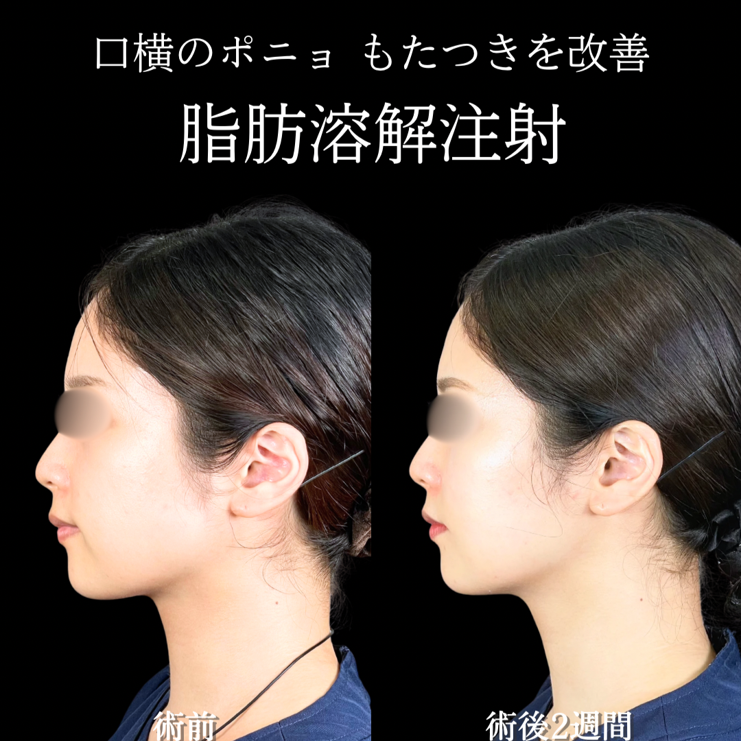 No.22088の症例写真
