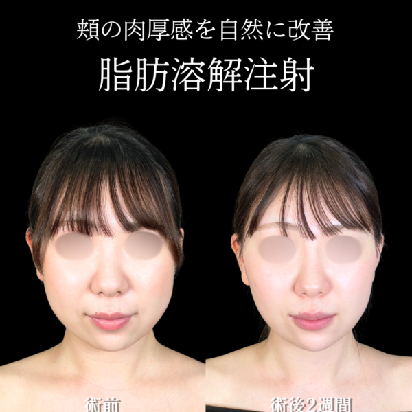 No.22068の症例写真
