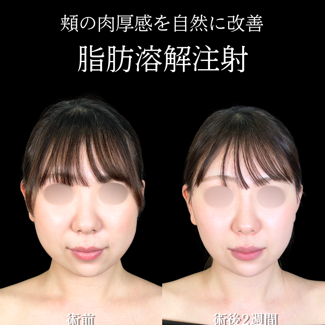 No.22068の症例写真