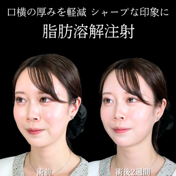No.22079の症例写真