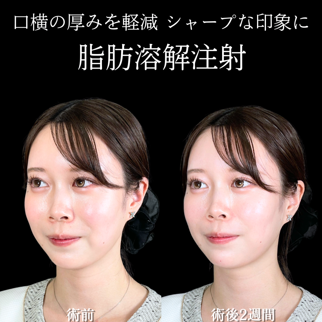 No.22079の症例写真