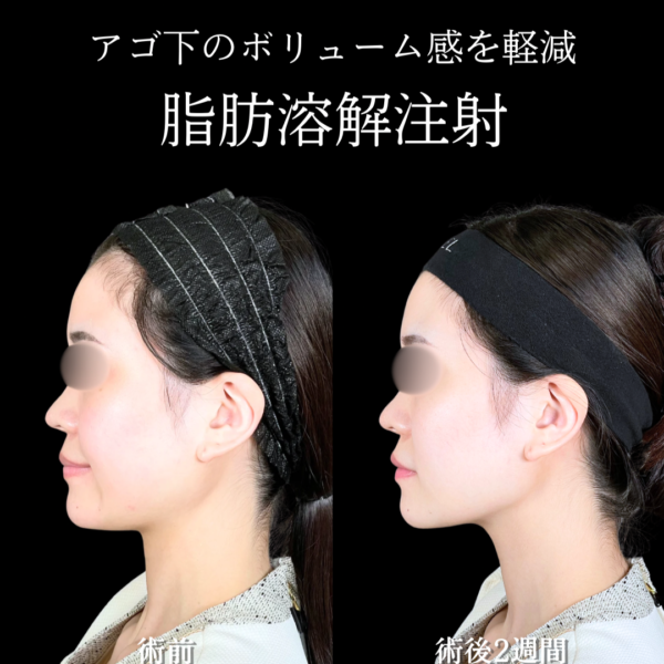 No.22084の症例写真